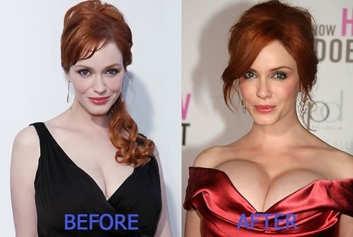 christina hendricks breast reduction Image 6